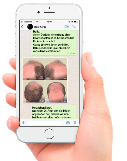 haar-transplantation-türkei-haartransplantation-istanbul-4