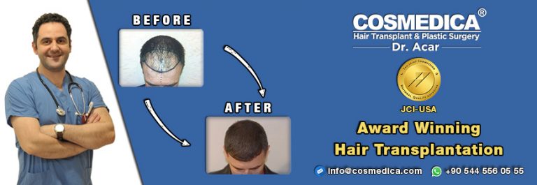 FUT Haartransplantation