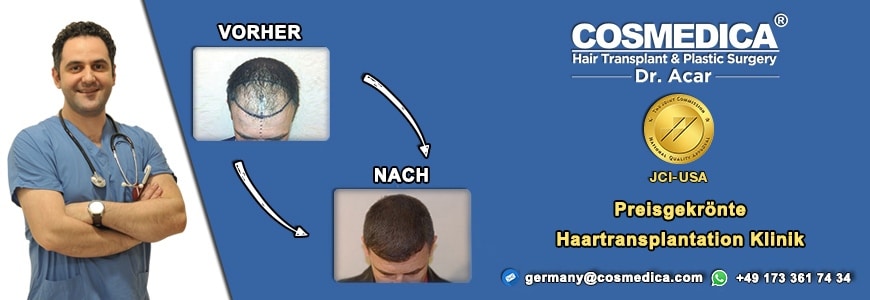 dr-acar-haar-transplantation-in-der-turkei-4
