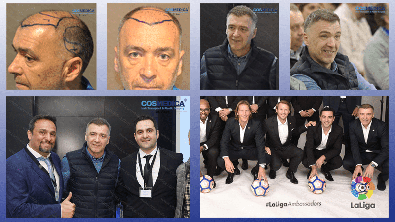 Haartransplantation-in-der-turkei-416