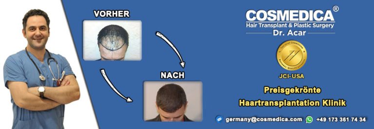 Haartransplantation Techniken