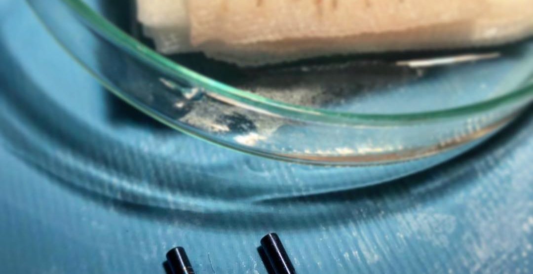 Saphire Haartransplantation Saphir Haartransplantation