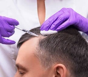 PRP Behandlung