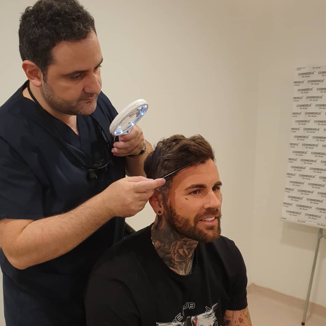 Haartransplantation Türkei Chris Perceval