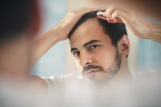 Minoxidil gegen beginnenden Haarausfall