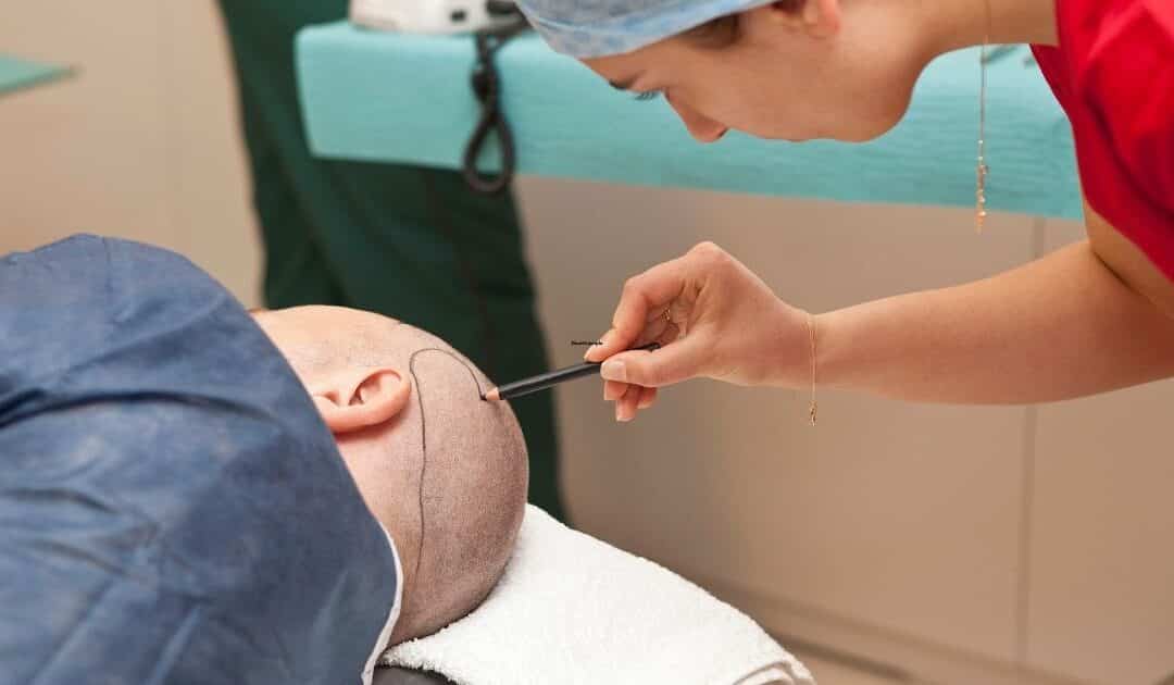 Medizintourismus Haartransplantation – Warum eine Haartransplantation in der Türkei günstiger ist