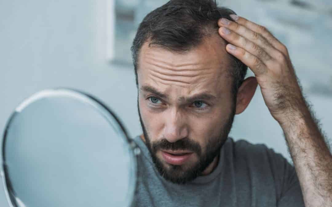 11 Mythen über Haarausfall – aufgedeckt!