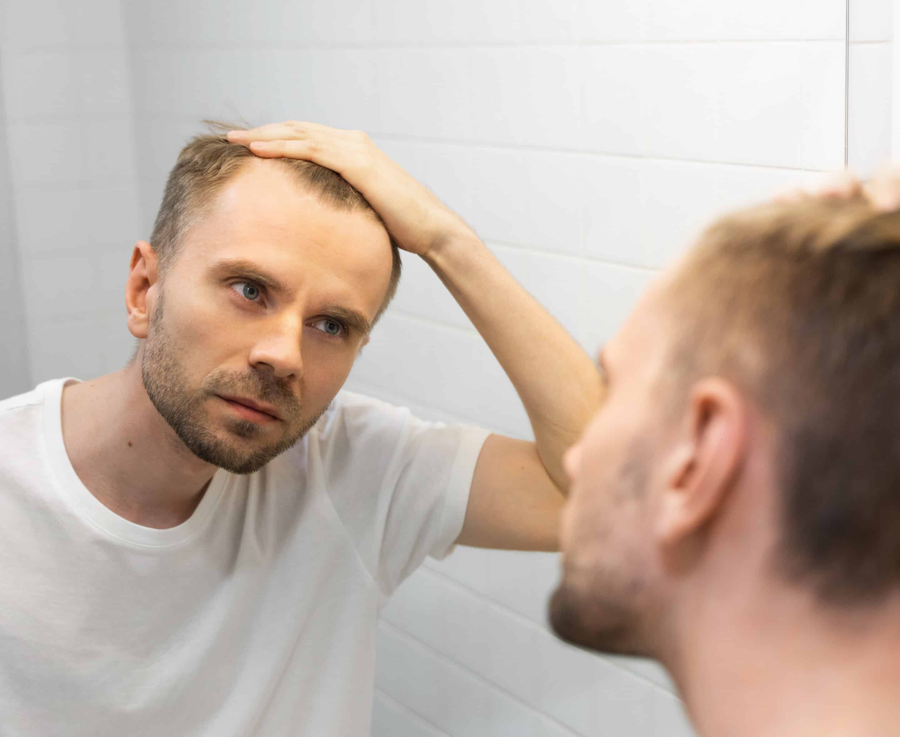 Hauptgründe für misslungene Haartransplantationen